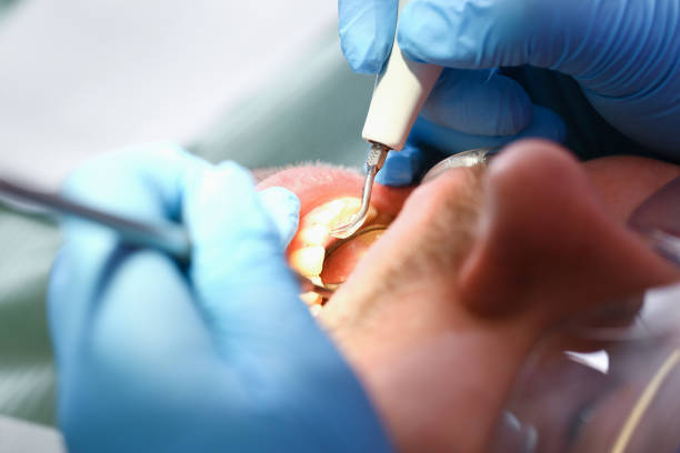 Best Emergency TMJ Treatment in Coatesville, PA