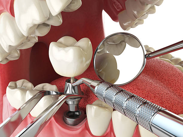 Best Emergency Dental Care for Broken or Chipped Teeth in Coatesville, PA